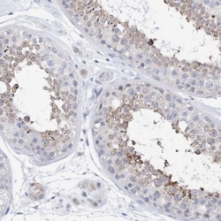 PLK4 Antibody, Novus Biologicals 0.1mL; Unlabeled:Antibodies, Polyclonal